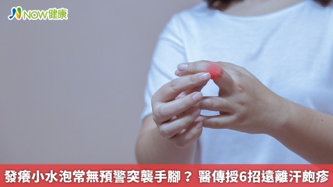 發癢小水泡常無預警突襲手腳？ 醫傳授6招遠離汗皰疹