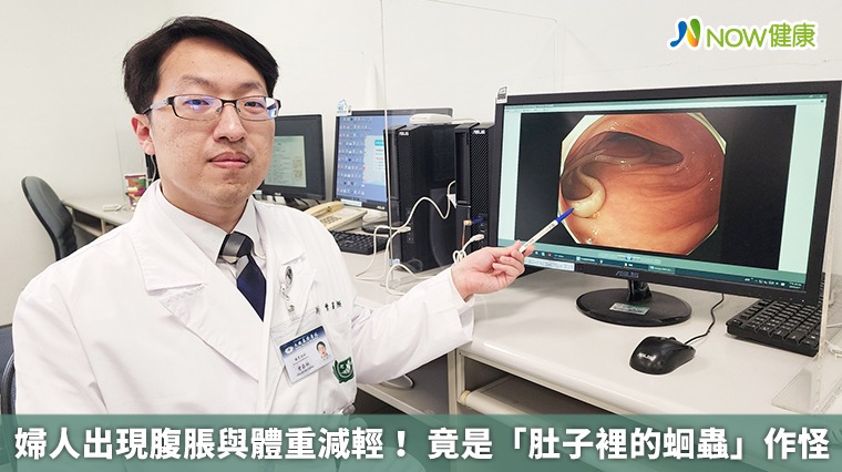 婦人出現腹脹與體重減輕！ 竟是「肚子裡的蛔蟲」作怪