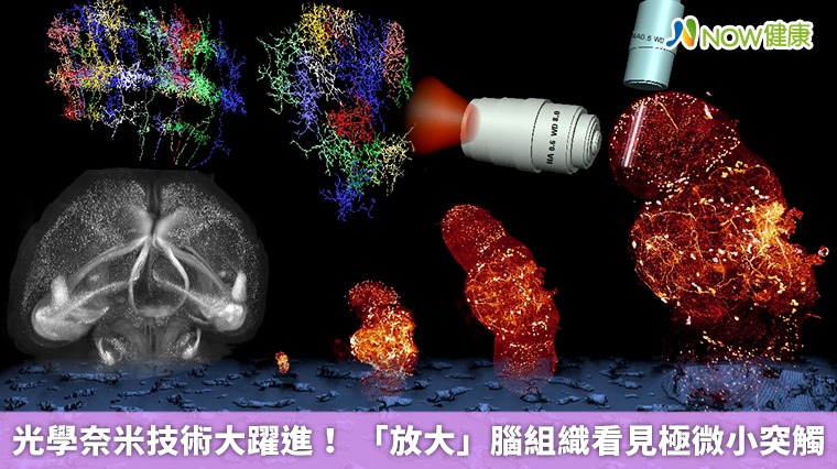 光學奈米技術大躍進! 「放大」腦組織看見極微小突觸 光學奈米技術大躍進! 「放大」腦組織看見極微小突觸
