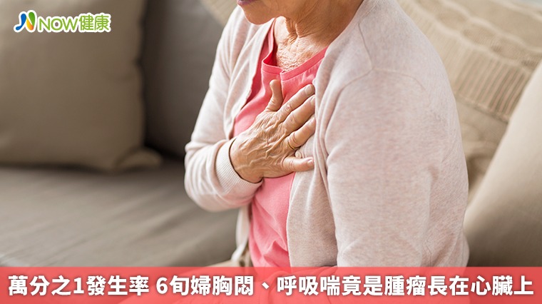 萬分之1發生率6旬婦胸悶、呼吸喘竟是腫瘤長在心臟上 萬分之1發生率6旬婦胸悶、呼吸喘竟是腫瘤長在心臟上