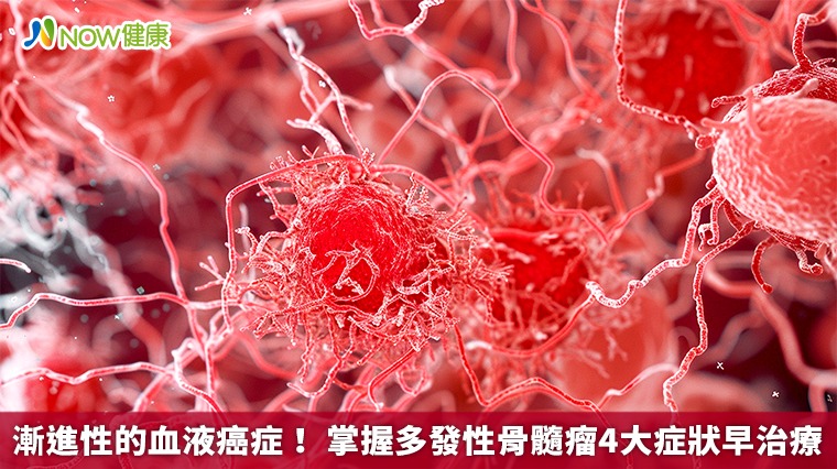 漸進性的血液癌症! 掌握多發性骨髓瘤4大症狀早治療 漸進性的血液癌症! 掌握多發性骨髓瘤4大症狀早治療