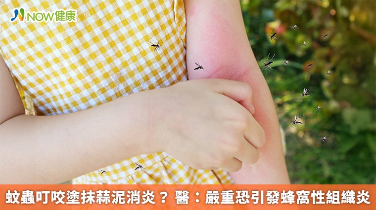 蚊蟲叮咬塗抹蒜泥消炎？ 醫：嚴重恐引發蜂窩性組織炎