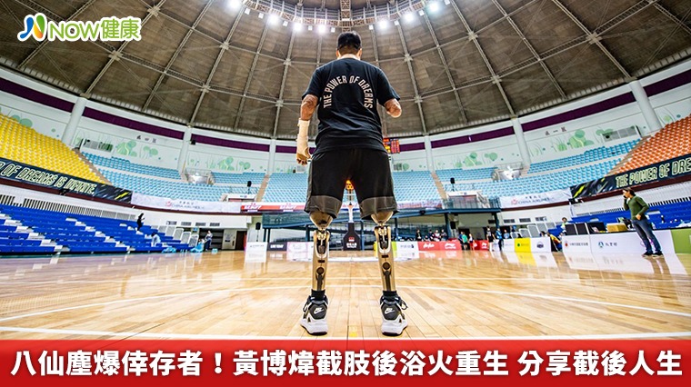 八仙塵爆倖存者！黃博煒截肢後浴火重生 分享截後人生