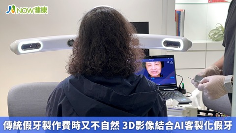傳統假牙製作費時又不自然 3D影像結合AI客製化假牙
