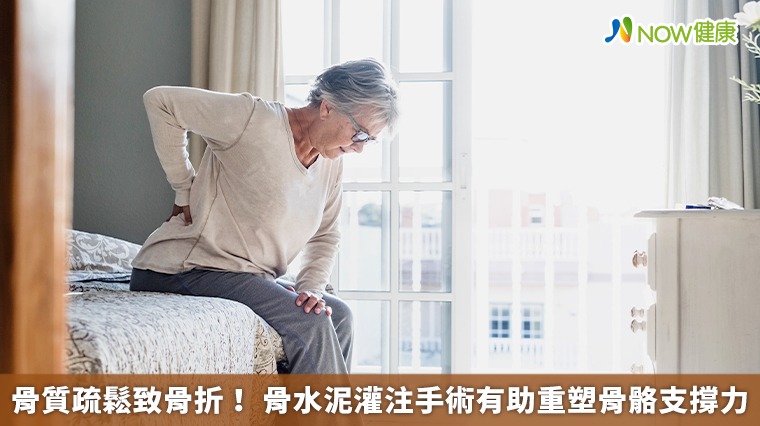 骨質疏鬆致骨折! 骨水泥灌注手術有助重塑骨骼支撐力 骨質疏鬆致骨折! 骨水泥灌注手術有助重塑骨骼支撐力