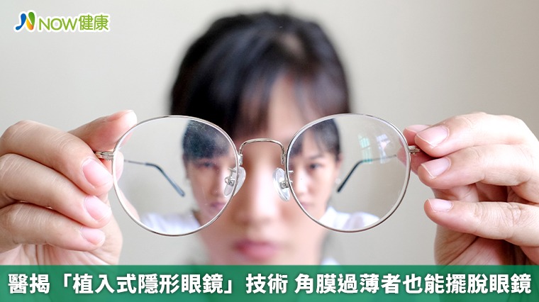 醫揭「植入式隱形眼鏡」技術 角膜過薄者也能擺脫眼鏡 醫揭「植入式隱形眼鏡」技術 角膜過薄者也能擺脫眼鏡