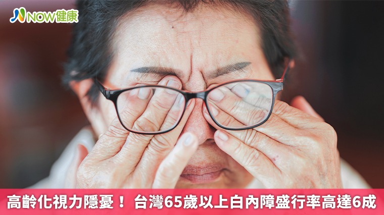 高齡化視力隱憂! 台灣65歲以上白內障盛行率高達6成 高齡化視力隱憂! 台灣65歲以上白內障盛行率高達6成