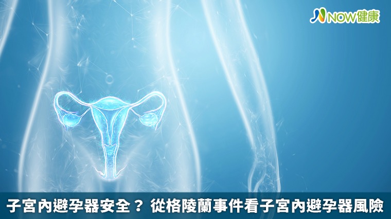 子宮內避孕器安全? 從格陵蘭事件看子宮內避孕器風險 子宮內避孕器安全? 從格陵蘭事件看子宮內避孕器風險