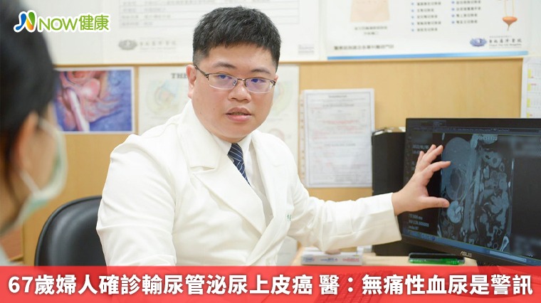 67歲婦人確診輸尿管泌尿上皮癌 醫:無痛性血尿是警訊 67歲婦人確診輸尿管泌尿上皮癌 醫:無痛性血尿是警訊