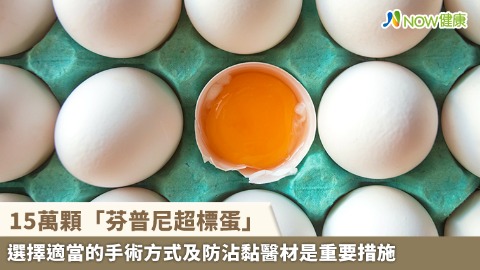 15萬顆「芬普尼超標蛋」流向全聯、楓康等10縣市 9品項完整名單曝光
