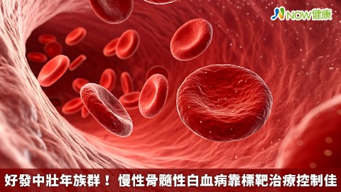 好發中壯年族群！ 慢性骨髓性白血病靠標靶治療控制佳
