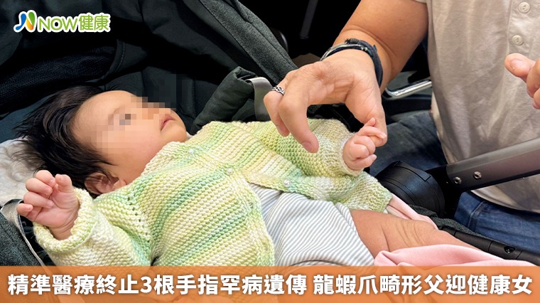 精準醫療終止3根手指罕病遺傳 龍蝦爪畸形父迎健康女
