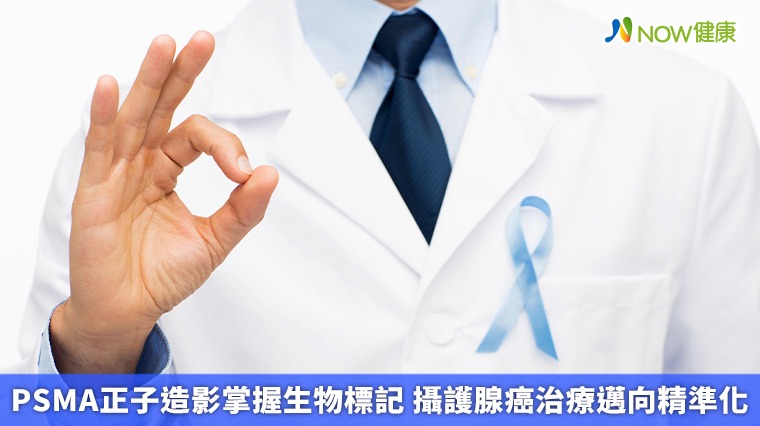PSMA正子造影掌握生物標記 攝護腺癌治療邁向精準化