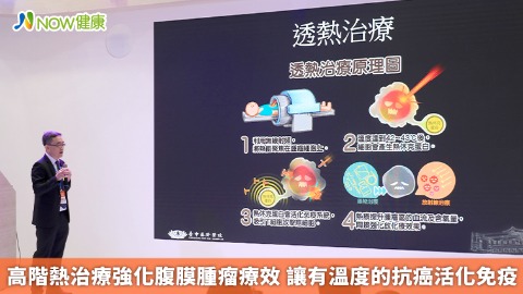高階熱治療強化腹膜腫瘤療效 讓有溫度的抗癌活化免疫