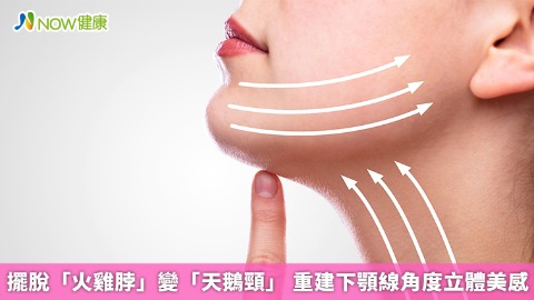 擺脫「火雞脖」變「天鵝頸」 重建下顎線角度立體美感