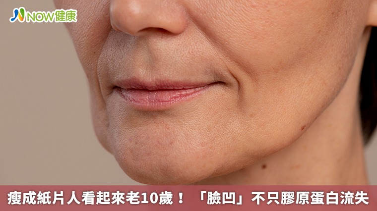 瘦成紙片人看起來老10歲！ 「臉凹」不只膠原蛋白流失