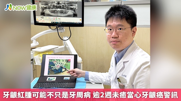 牙齦紅腫可能不只是牙周病 逾2週未癒當心牙齦癌警訊