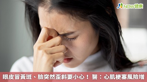 眼皮冒黃斑、臉突然歪斜要小心！ 醫：心肌梗塞風險增