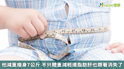 他減重瘦身7公斤 不只體重減輕連脂肪肝也跟著消失了