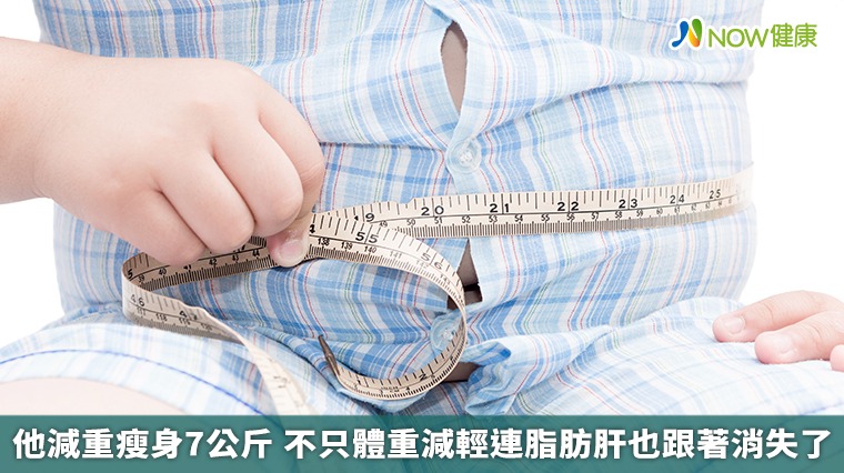 他減重瘦身7公斤 不只體重減輕連脂肪肝也跟著消失了