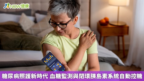糖尿病照護新時代 血糖監測與閉環胰島素系統自動控糖