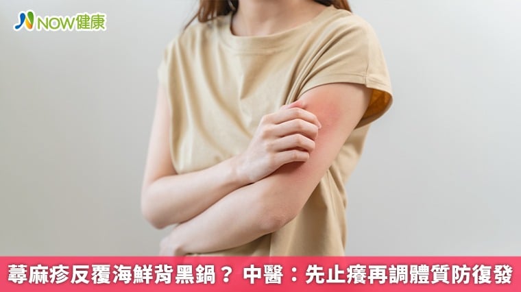蕁麻疹反覆海鮮背黑鍋？ 中醫：先止癢再調體質防復發