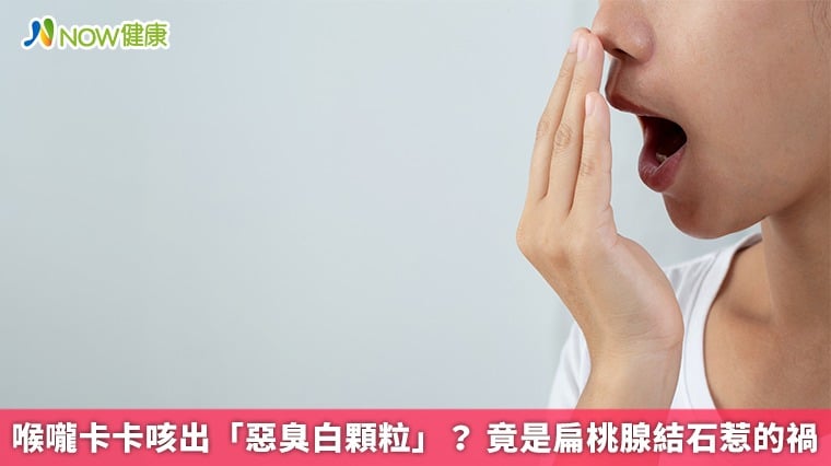 喉嚨卡卡咳出「惡臭白顆粒」？ 竟是扁桃腺結石惹的禍