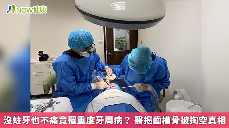 沒蛀牙也不痛竟罹重度牙周病？ 醫揭齒槽骨被掏空真相