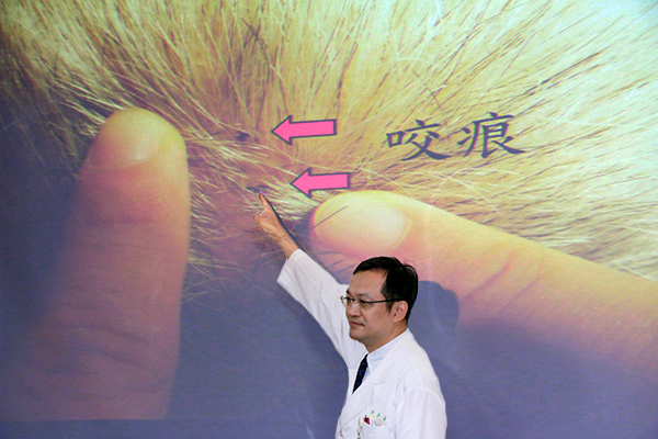 陳燕嘉醫師發表龜殼花咬傷頭部個案