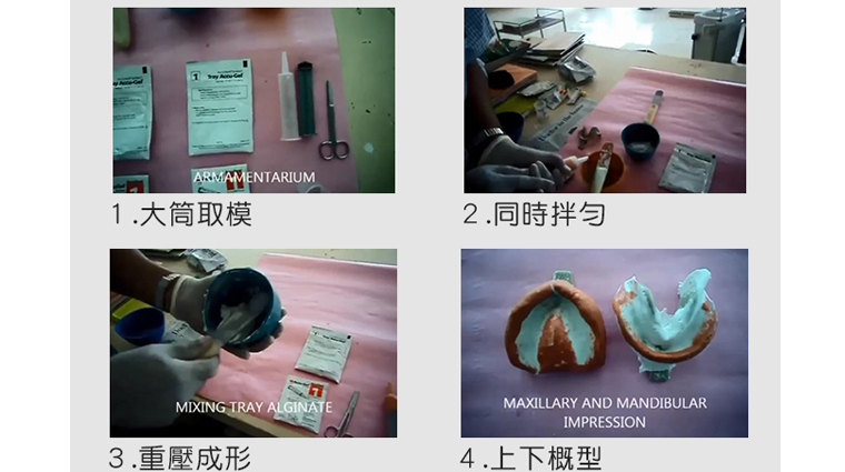 高齡缺牙笑容卡卡 全口假牙找回顏值有面子 全口假牙製作之初步流程圖。(圖/美生誠愷提供)